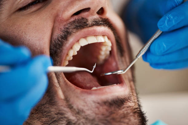 Best Emergency Treatment for Dental Infections or Abscesses in Delta Junction, AK